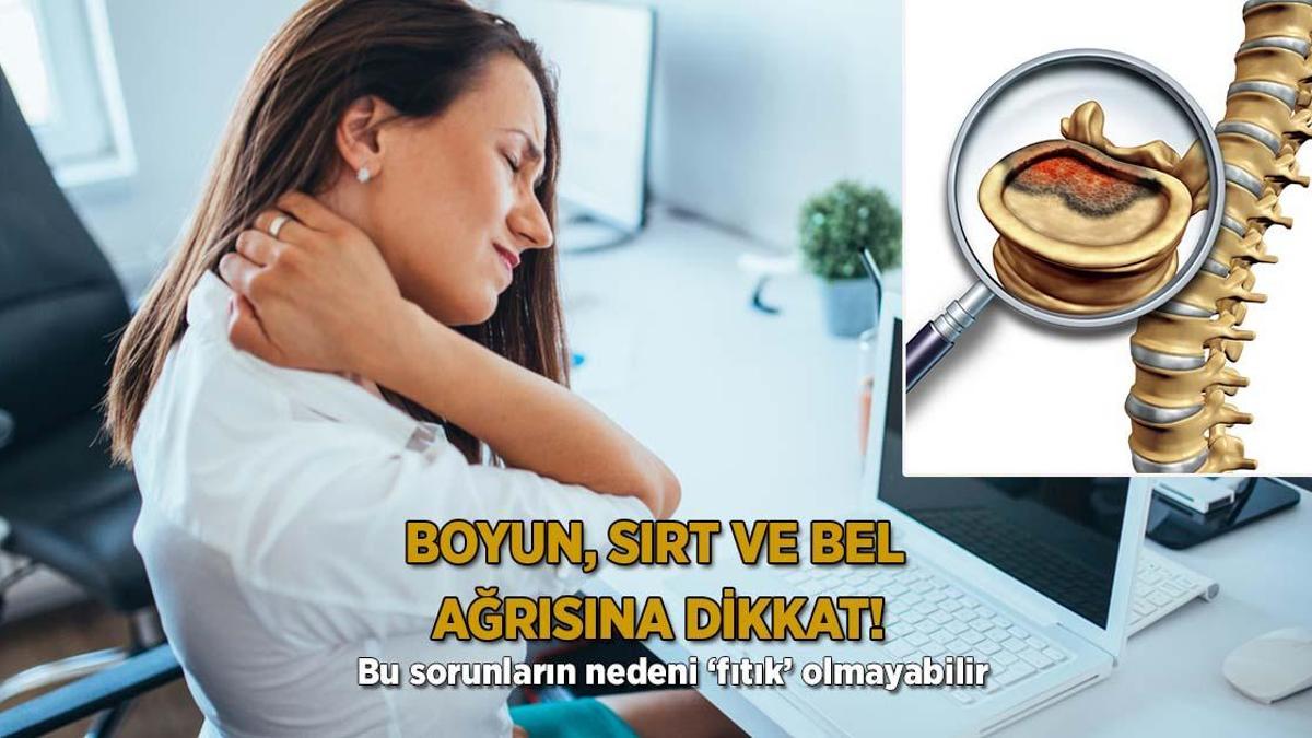 Boyun, sırt ve bel ağrısına dikkat! ‘Bu sorunların nedeni ‘fıtık’ olmayabilir